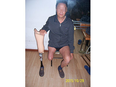 青島假肢與矯形器服務探析——以青島市遠征假肢矯形器為例